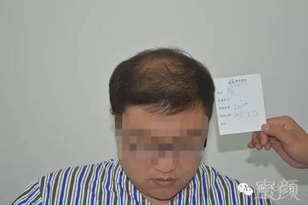 https://img.miyanlife.com/mnt/timg/190315/131Ta628-1.jpg