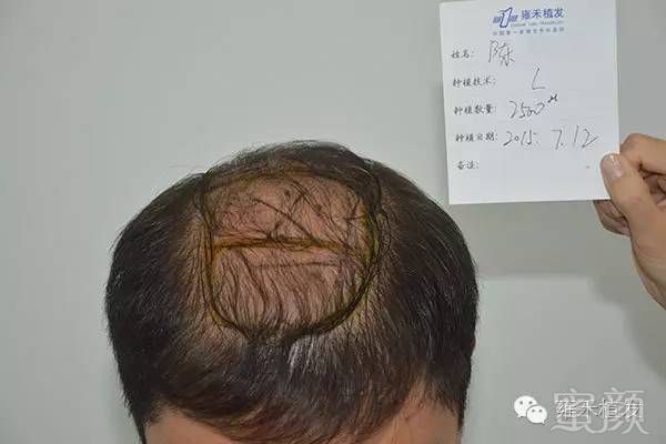 https://img.miyanlife.com/mnt/timg/190315/131U4L07-4.jpg