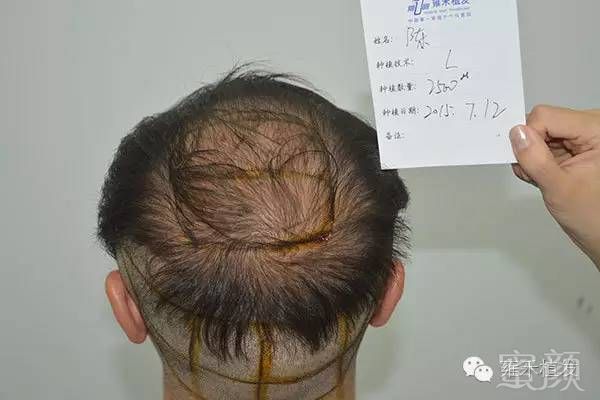 https://img.miyanlife.com/mnt/timg/190315/131U559B-5.jpg