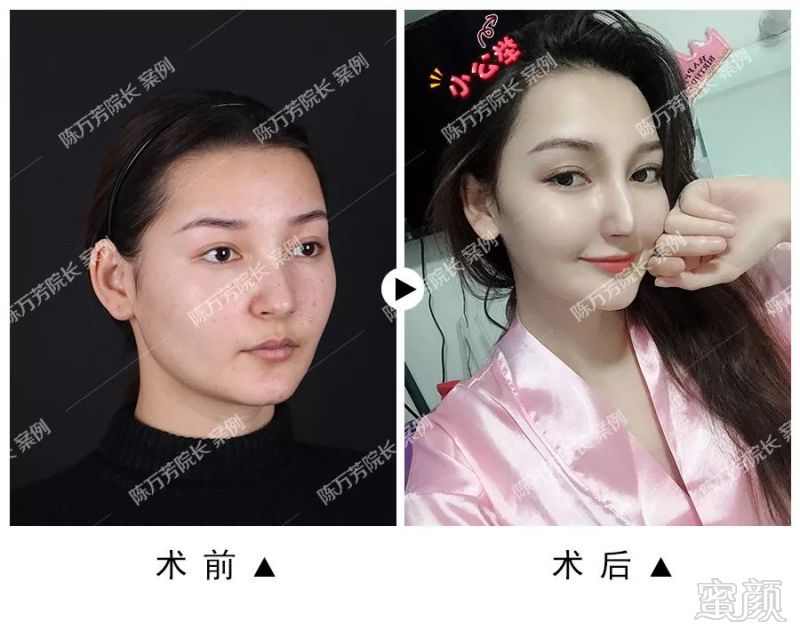 https://img.miyanlife.com/mnt/timg/190316/1406132538-5.jpg