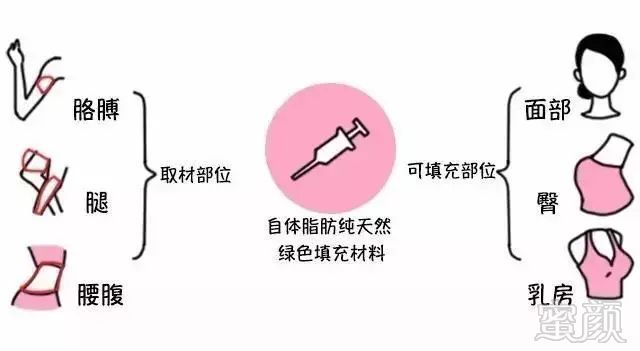 https://img.miyanlife.com/mnt/timg/190316/1426222K7-2.jpg