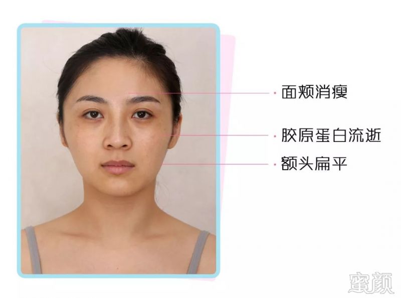 https://img.miyanlife.com/mnt/timg/190316/1426225315-3.jpg