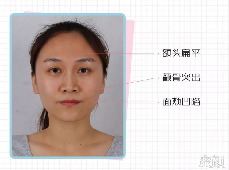 https://img.miyanlife.com/mnt/timg/190316/1426244123-7.jpg