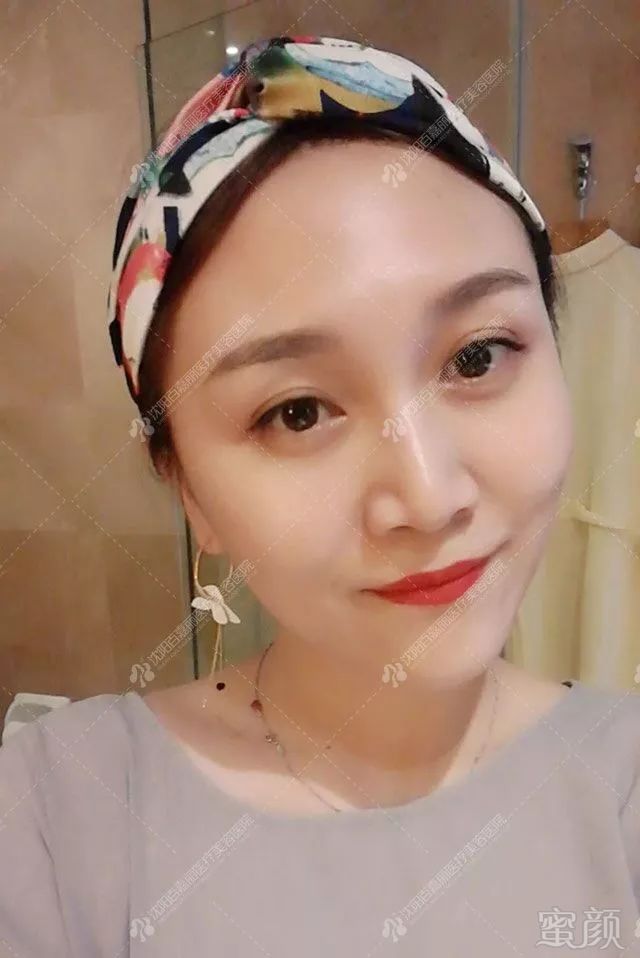 https://img.miyanlife.com/mnt/timg/190316/1426252W8-9.jpg