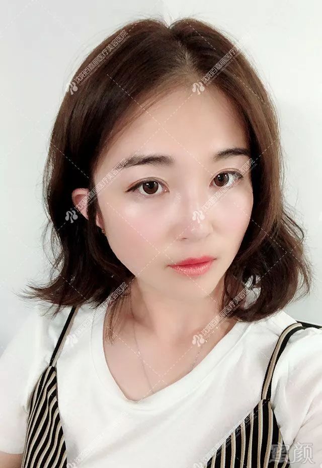 https://img.miyanlife.com/mnt/timg/190316/14262HA8-15.jpg