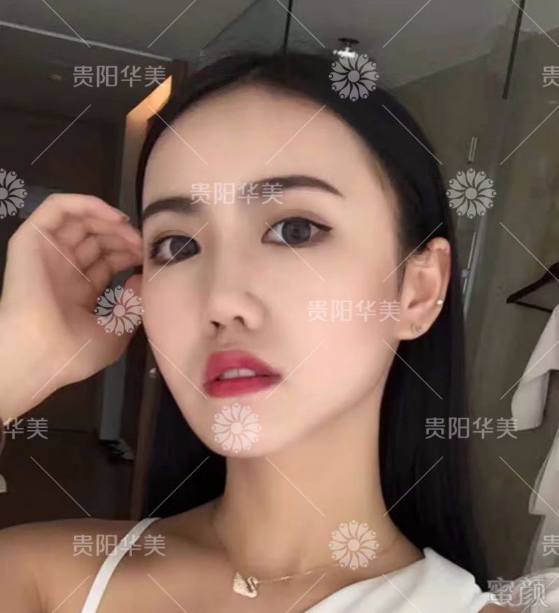 https://img.miyanlife.com/mnt/timg/190317/130I05550-0.jpg