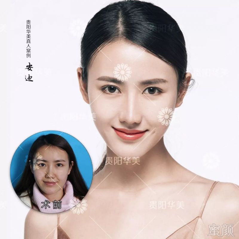 https://img.miyanlife.com/mnt/timg/190317/130IC5c-6.jpg