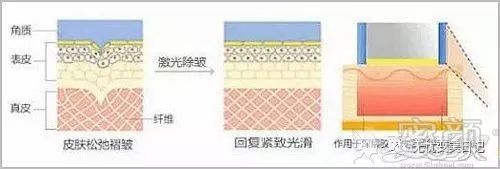 https://img.miyanlife.com/mnt/timg/190319/1236436107-1.jpg