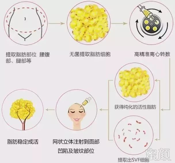 https://img.miyanlife.com/mnt/timg/190319/13022S295-2.jpg