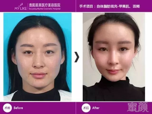 https://img.miyanlife.com/mnt/timg/190319/13022U323-4.jpg