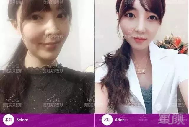 https://img.miyanlife.com/mnt/timg/190319/13022UN5-5.jpg