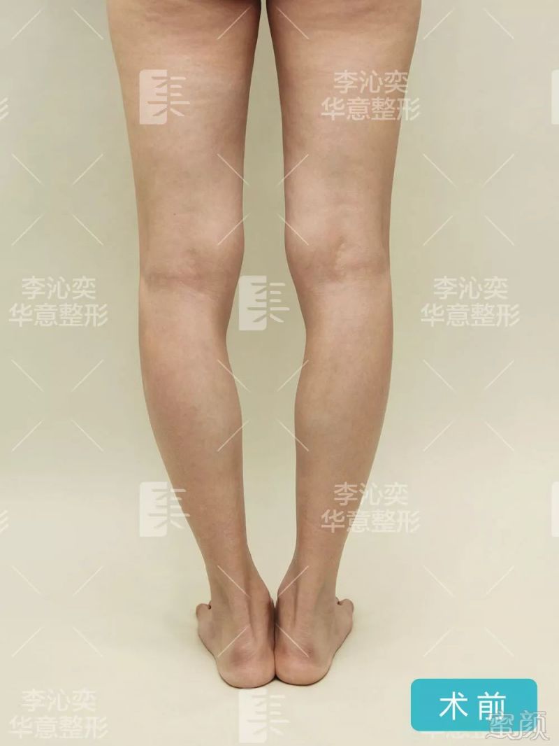 https://img.miyanlife.com/mnt/timg/190319/131P32234-1.jpg