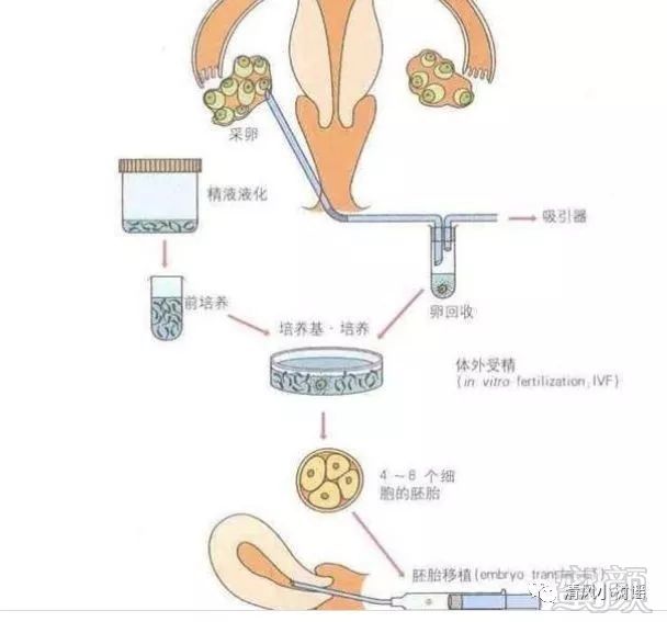 案例图片