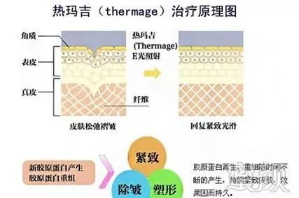 https://img.miyanlife.com/mnt/timg/190321/1254522528-1.jpg