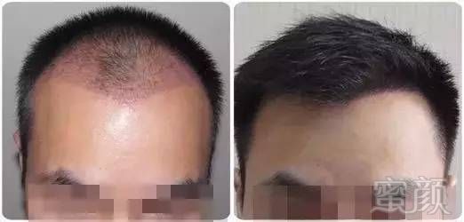 https://img.miyanlife.com/mnt/timg/190321/14114264G-6.jpg