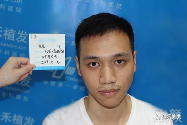 https://img.miyanlife.com/mnt/timg/190322/1303151441-4.jpg