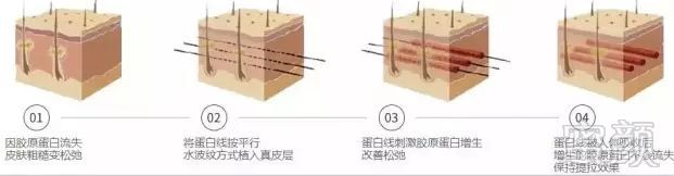 案例图片