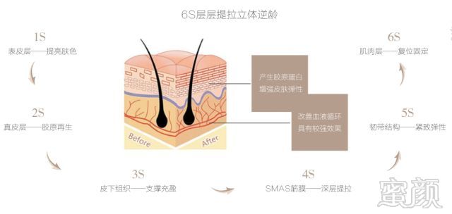 案例图片