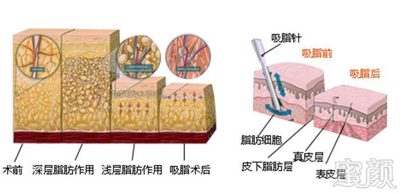 案例图片