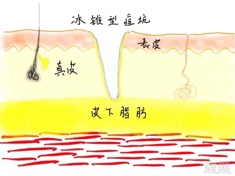 https://img.miyanlife.com/mnt/timg/190323/14302A353-5.jpg