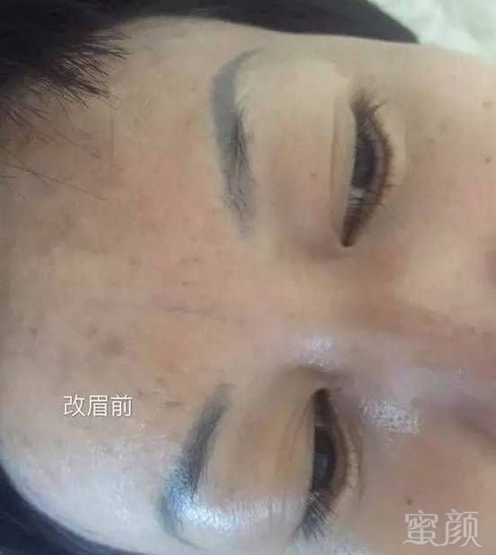 案例图片