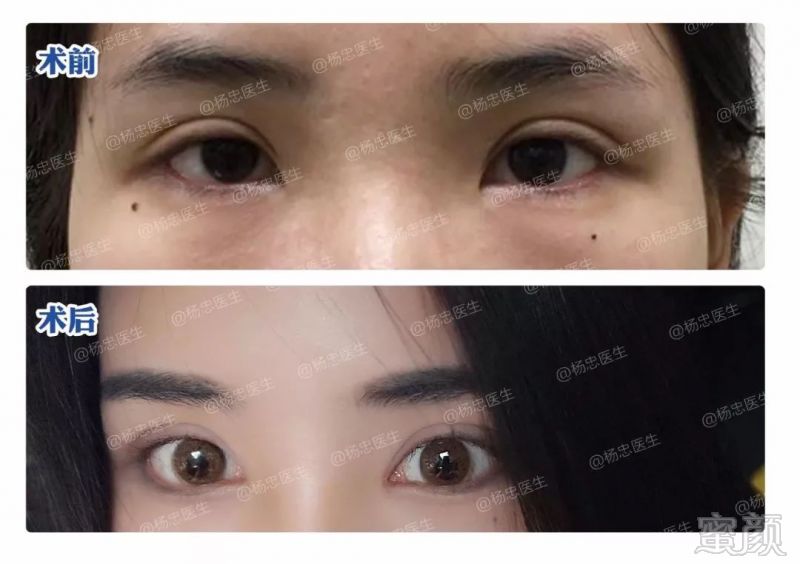 https://img.miyanlife.com/mnt/timg/190324/1I2252R0-8.jpg
