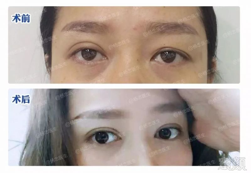 https://img.miyanlife.com/mnt/timg/190324/1I225KR-7.jpg