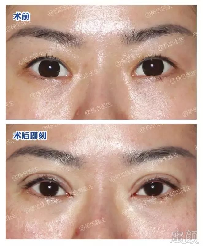 https://img.miyanlife.com/mnt/timg/190324/1I2263U3-10.jpg