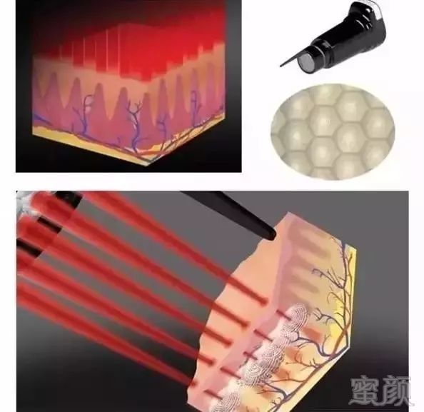 https://img.miyanlife.com/mnt/timg/190324/1K314F11-8.jpg