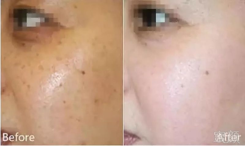 https://img.miyanlife.com/mnt/timg/190324/1K315B05-15.jpg