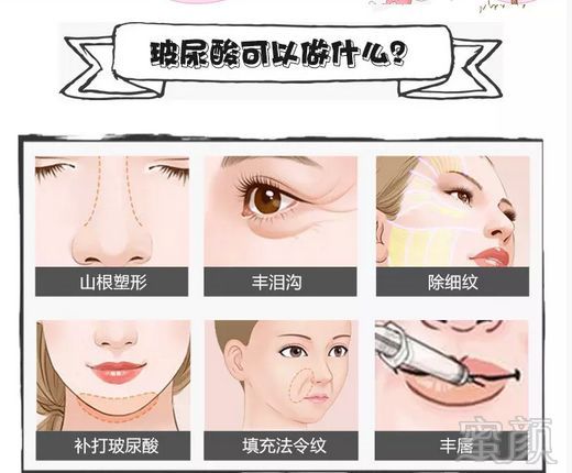 https://img.miyanlife.com/mnt/timg/190326/14330522T-4.jpg