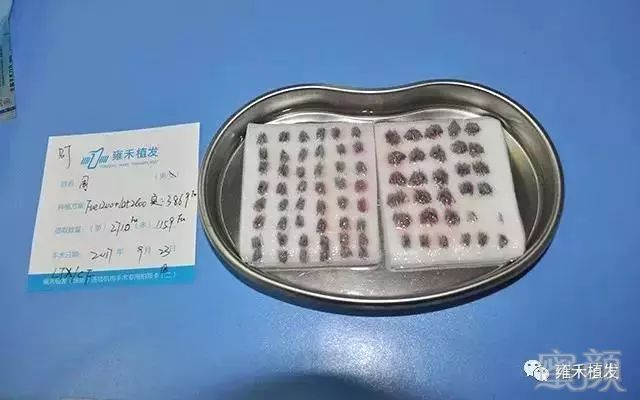 https://img.miyanlife.com/mnt/timg/190326/1443235M3-3.jpg