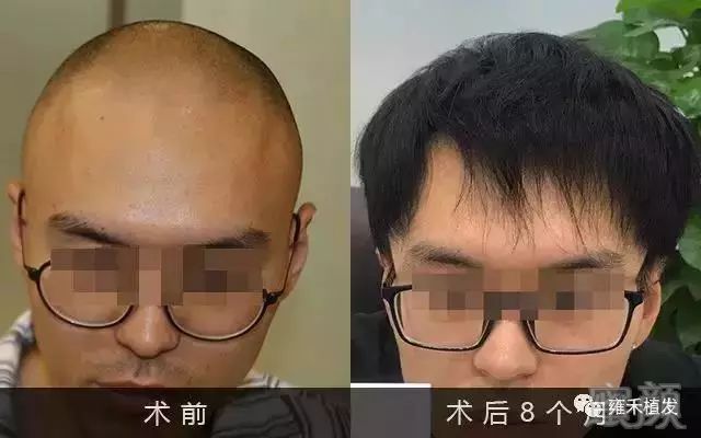 https://img.miyanlife.com/mnt/timg/190326/14433421a-8.jpg