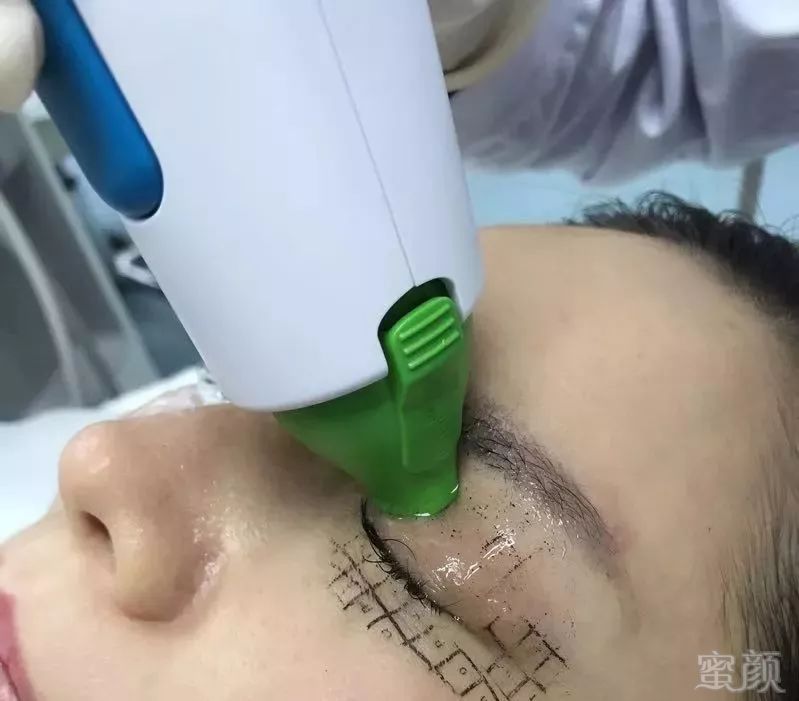 https://img.miyanlife.com/mnt/timg/190326/14493524H-7.jpg