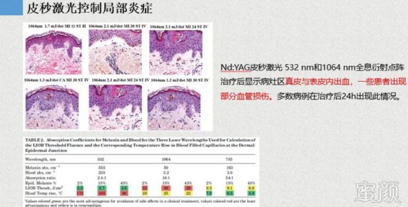 https://img.miyanlife.com/mnt/timg/190326/1519342511-4.jpg
