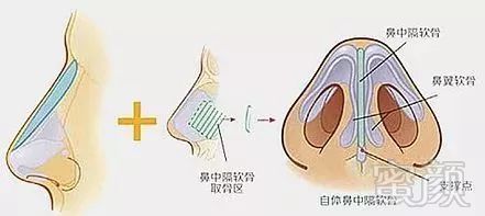 案例图片