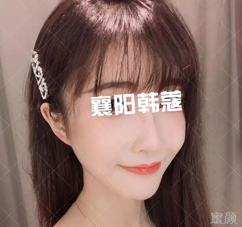 https://img.miyanlife.com/mnt/timg/190328/1454012639-1.jpg