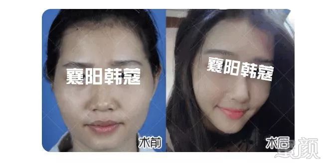 https://img.miyanlife.com/mnt/timg/190328/14541931N-14.jpg