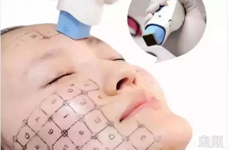 https://img.miyanlife.com/mnt/timg/190328/1522513012-5.jpg