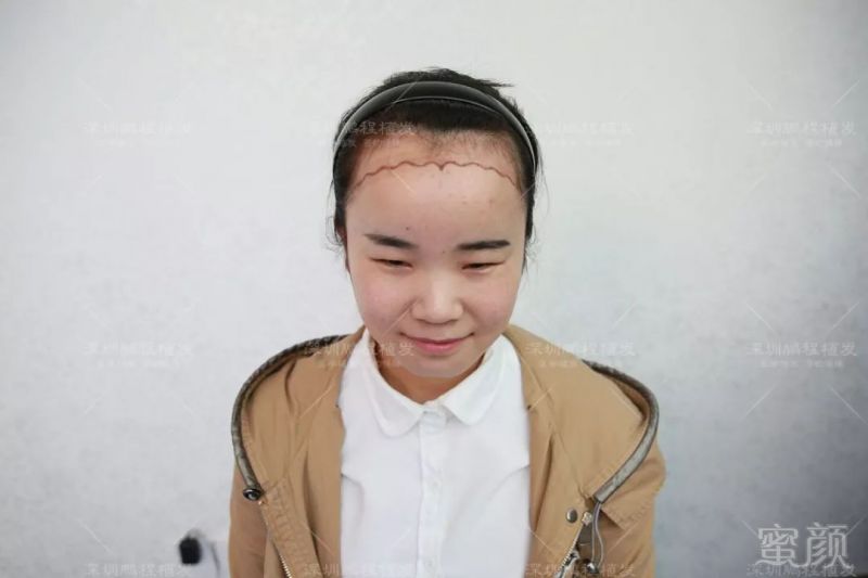https://img.miyanlife.com/mnt/timg/190328/15392H5C-0.jpg