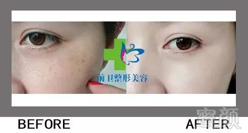 https://img.miyanlife.com/mnt/timg/190328/1543132432-10.jpg