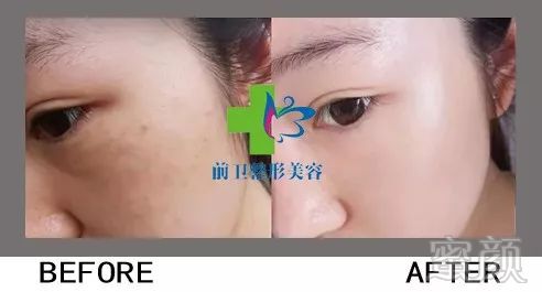 https://img.miyanlife.com/mnt/timg/190328/1543133348-9.jpg