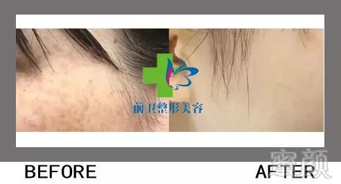 https://img.miyanlife.com/mnt/timg/190328/1543145553-11.jpg