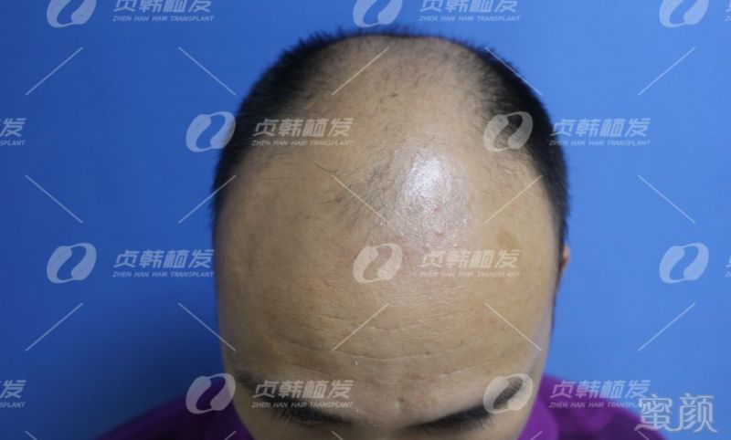 https://img.miyanlife.com/mnt/timg/190328/1543152259-1.jpg