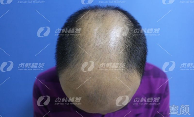 https://img.miyanlife.com/mnt/timg/190328/1543162B3-2.jpg