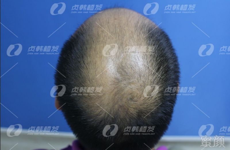https://img.miyanlife.com/mnt/timg/190328/15431J126-3.jpg