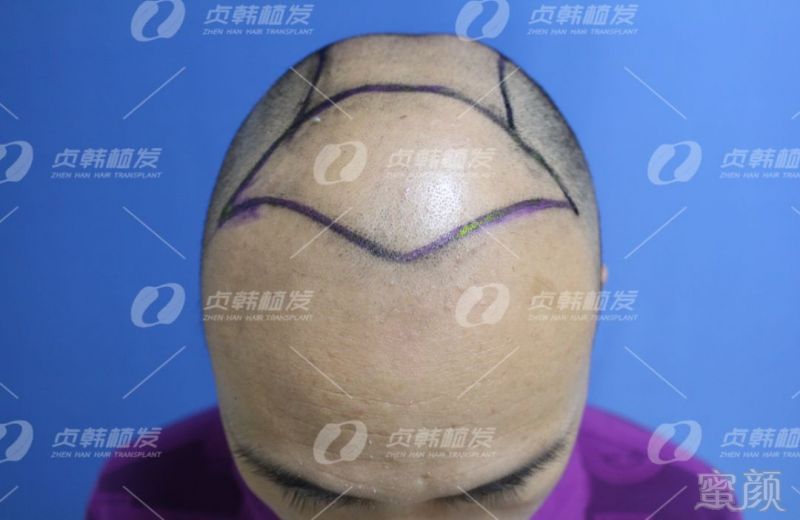 https://img.miyanlife.com/mnt/timg/190328/15431L348-4.jpg