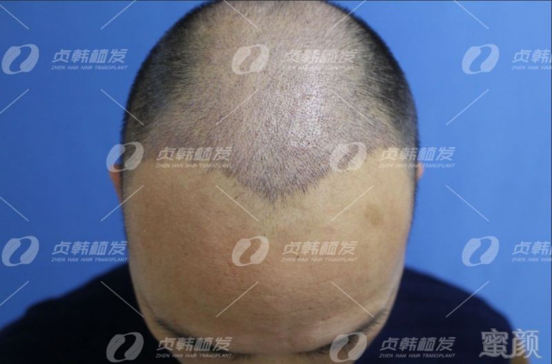 https://img.miyanlife.com/mnt/timg/190328/15431T623-5.jpg