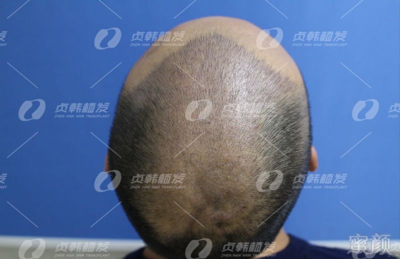 https://img.miyanlife.com/mnt/timg/190328/15431V143-6.jpg