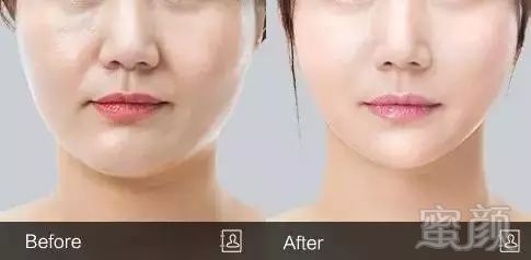 https://img.miyanlife.com/mnt/timg/190328/15450T094-5.jpg